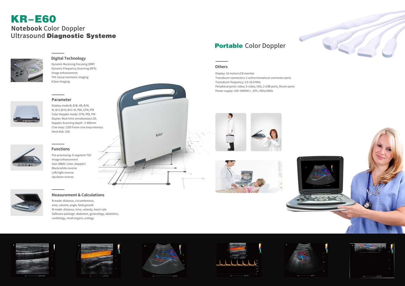 KR-E60筆記本彩超機